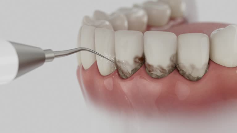 Reliable Dental Implants contractor in Oak Grove, MN by Smile Center Dentistry